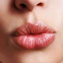 Трещины в уголках рта: причины и лечение