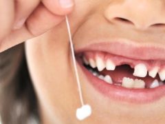 Показания для удаления зубов у маленьких детей