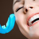 Методы выравнивания зубов без брекетов